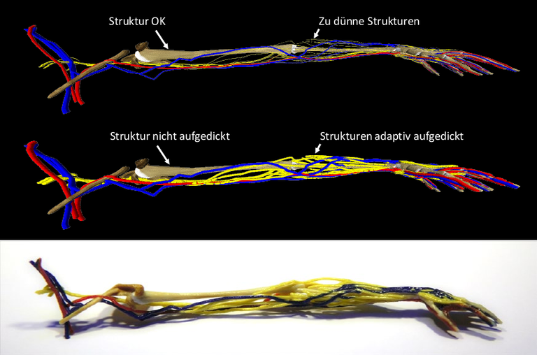 Darstellung eines Anatomiemodels mit Strukturen wie Nerven und Blutgefäßen